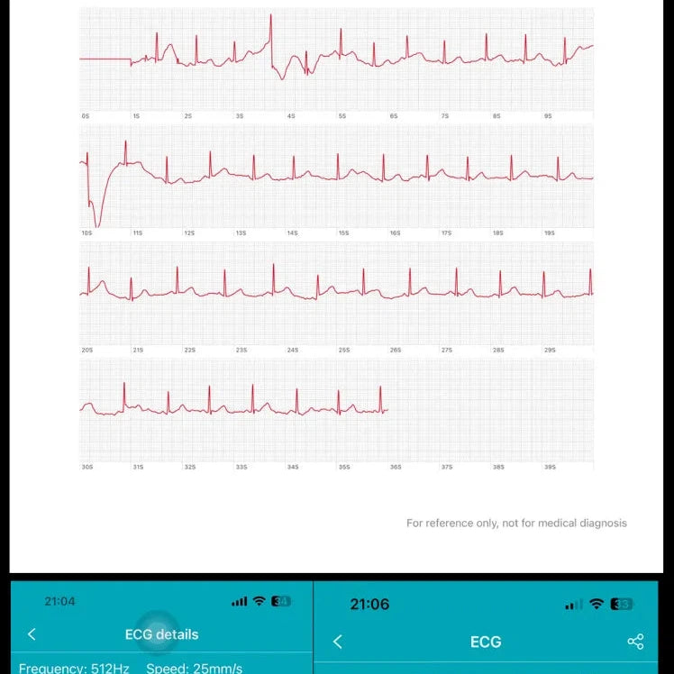 NORTH EDGE Health Plus Glucose Heart Smart Watch